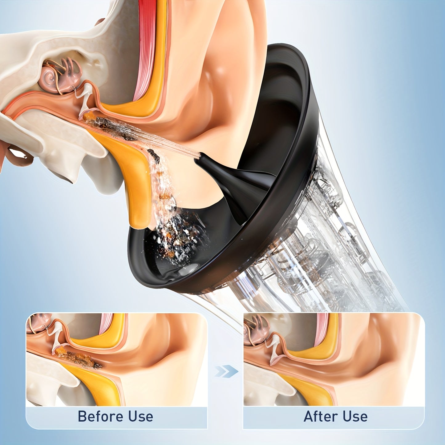 Upgraded Electric Ear Wax Removal Tool, Water Powered Ear Cleaning Tool with Irrigation Flusher, 6 Tips, 4 Pressure Settings -Safe & Effective for Ear Wax Buildup Flushing And Cleaning, Waterproof & Convenient Ear Flushing Ki