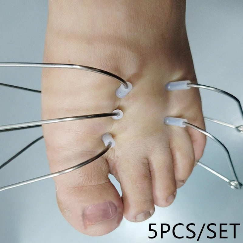 Stainless Steel Acupoint Massager Ring 3-in-1 Hand Palm Foot Acupoint Clip Portable Pressure Stimulator Acupoint Massager Clip